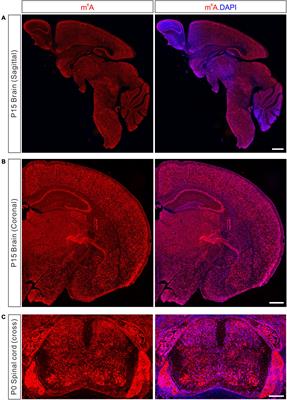 m6A Modification in Mammalian Nervous System Development, Functions, Disorders, and Injuries